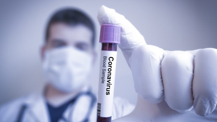 Corona virüsü için kan testi yapılmış olan hastanın sonucunu elinde tutan doktor.
