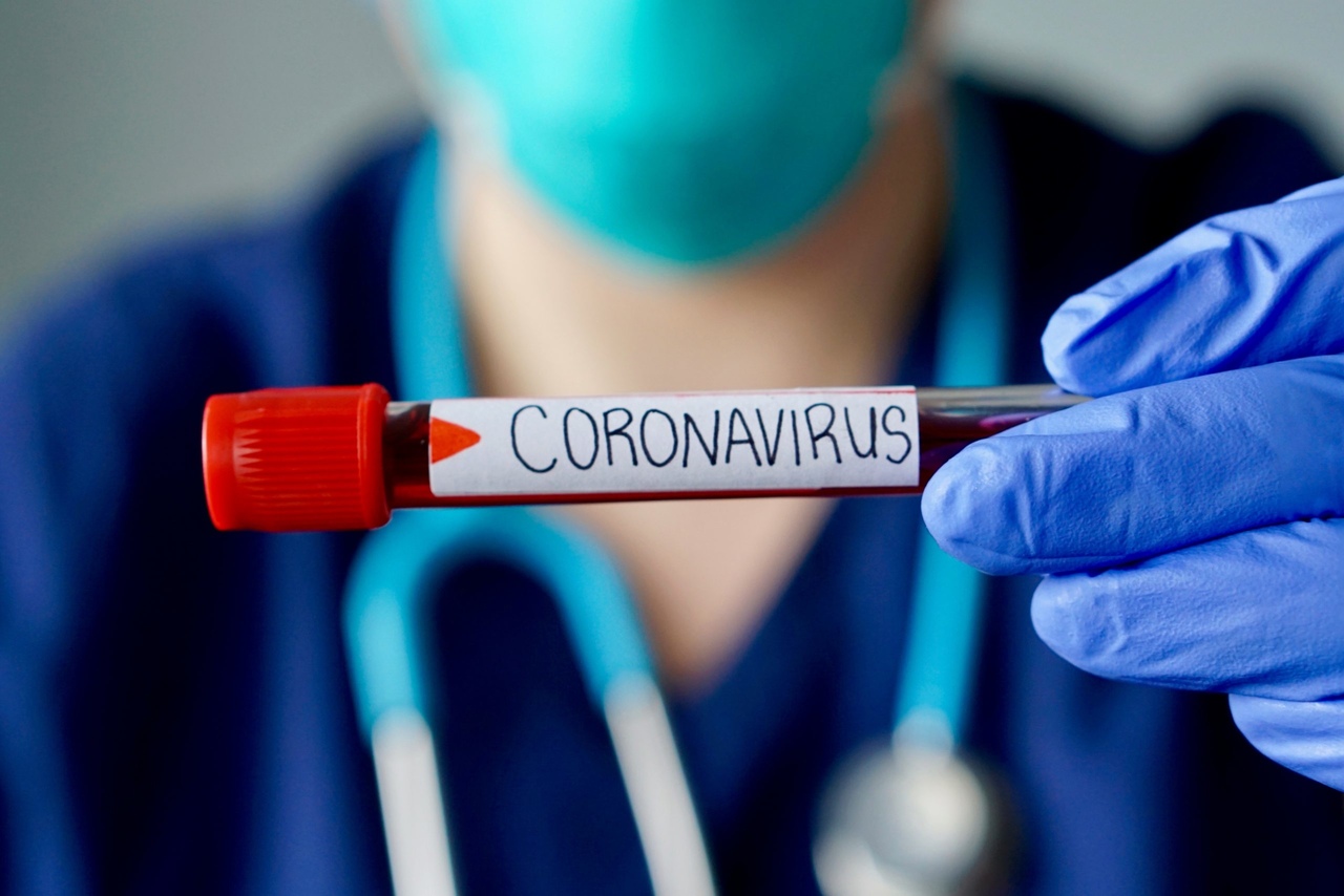 Mavi eldivenli doktorun elinde bulunan corona şüphesi olan hastaya ait kan tahlili